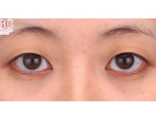 今月のベスト症例写真