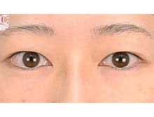 今月のベスト症例写真