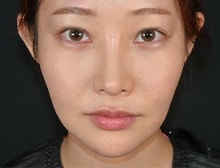 今月のベスト症例写真