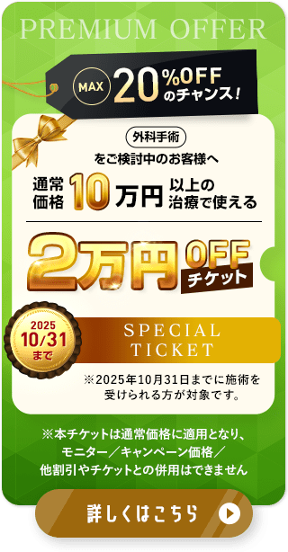 2万円OFFチケット配布中