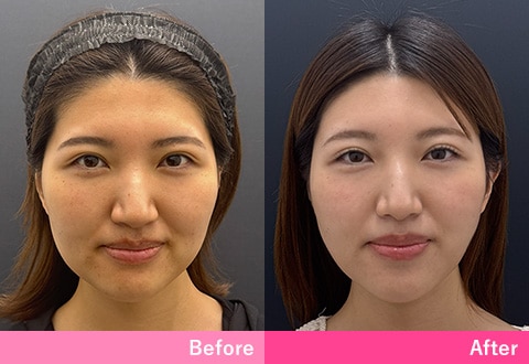 症例写真5