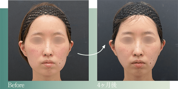 症例写真3