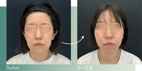 症例写真4
