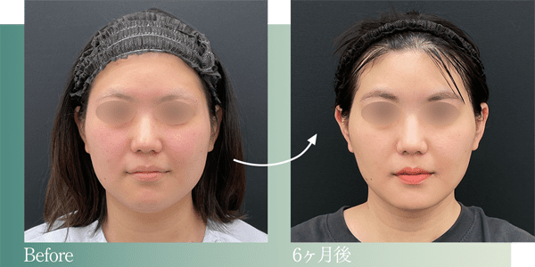 症例写真5