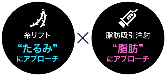 オルチャンリフト