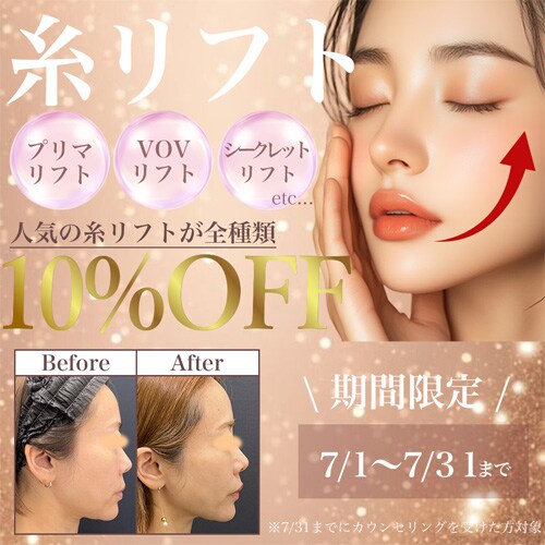 糸リフト全種類10％OFF！