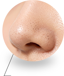 毛穴のざらつき、開きが気になる方