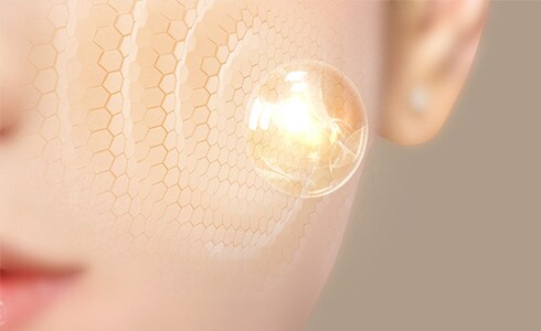 エレクトロポレーション（イオン導入）(オプション治療)