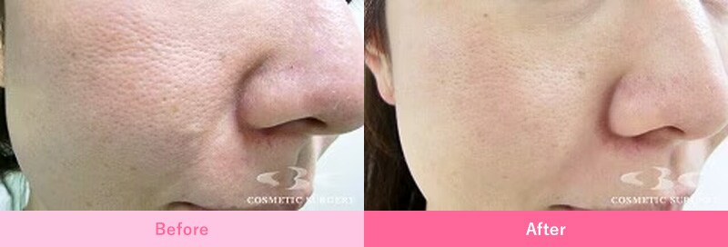 ピックアップ症例