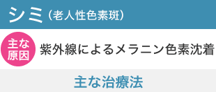 シミ(老人性色素斑)