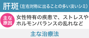 肝斑(左右対称に出ることの多い淡いシミ)