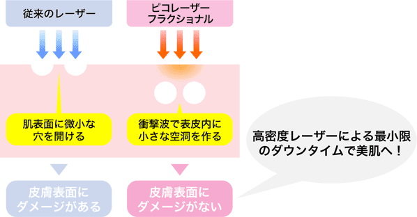 高密度レーザーによる最小限のダウンタイムで美肌へ！