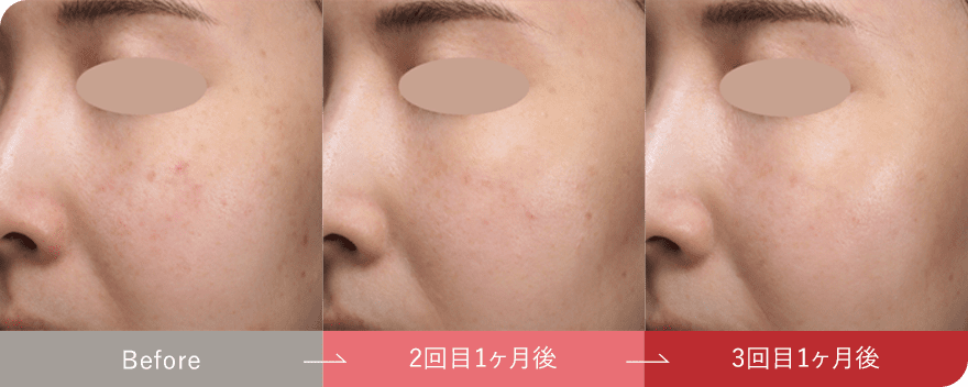 症例写真3