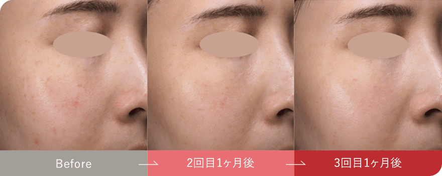 症例写真4