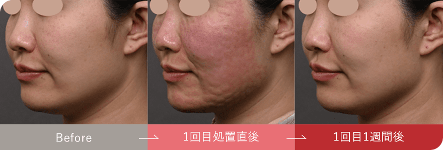 症例写真4