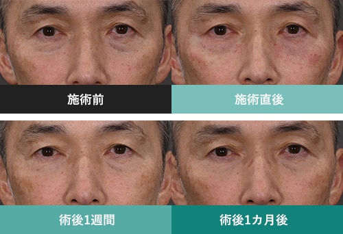 症例写真1