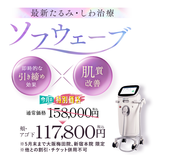 ソフウェーブ