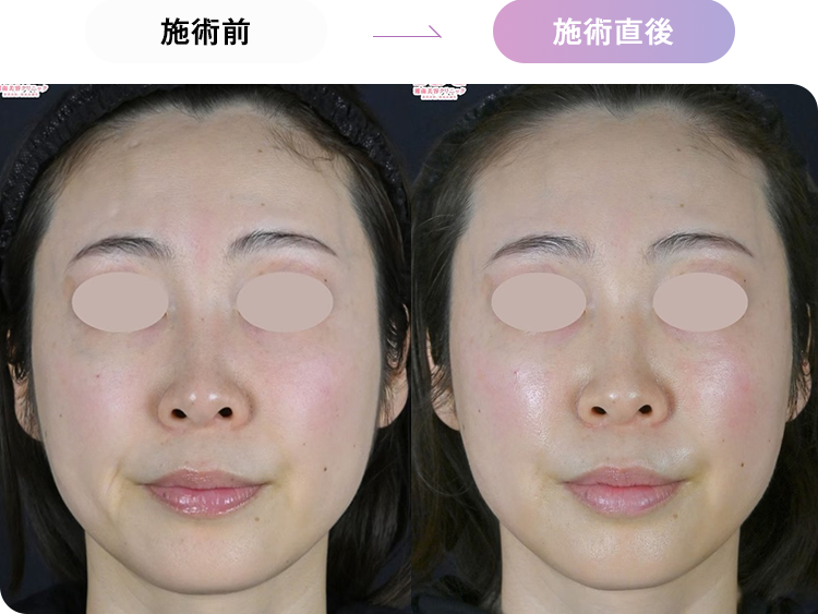 症例写真