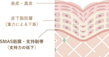 たるみの原因 イメージ