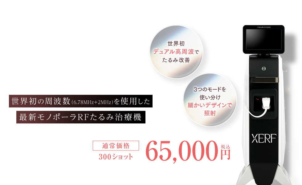 XERF(ザーフ)