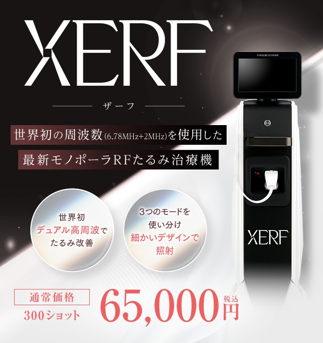 XERF(ザーフ)