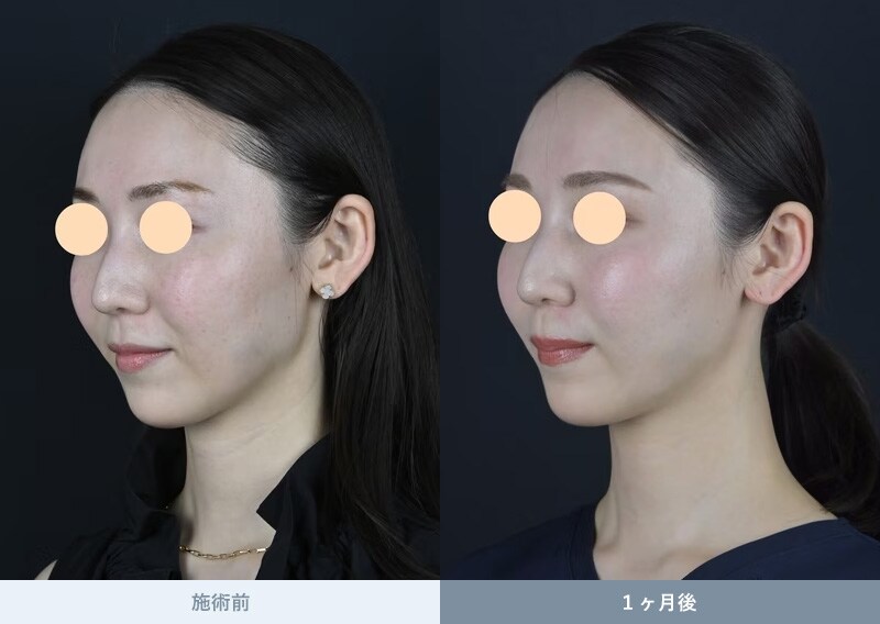 DENSITY（デンシティ） 症例写真