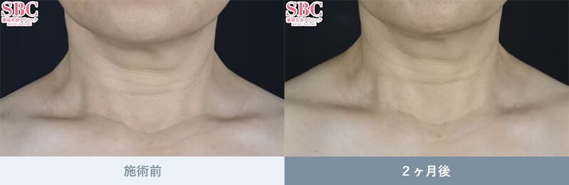 DENSITY（デンシティ） 症例写真