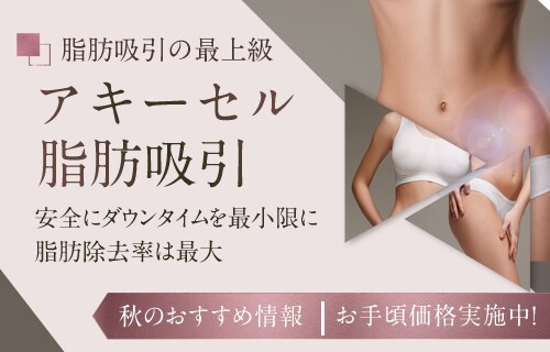 アキーセル