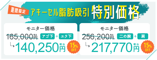 今月のキャンペーン