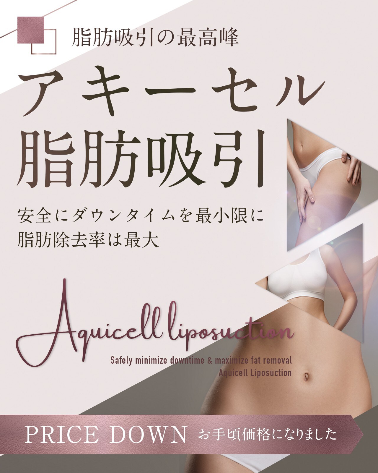 Aquicell（アキーセル）脂肪吸引