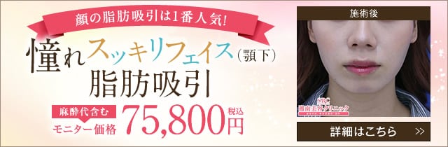 脂肪吸引の費用 料金 脂肪吸引なら湘南美容クリニック 公式 脂肪吸引の費用 料金 脂肪吸引なら湘南美容クリニック 公式
