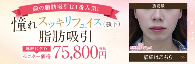 脂肪吸引の費用 料金 脂肪吸引なら湘南美容クリニック 公式