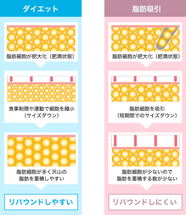 ダイエットと脂肪吸引の比較