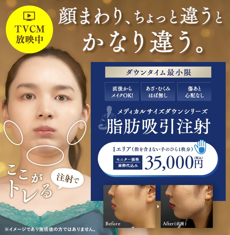 mm様専用 脂肪吸引・注入術