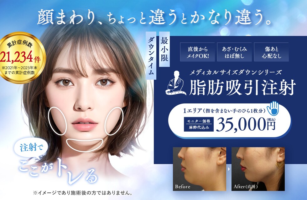 小顔用脂肪吸引注射