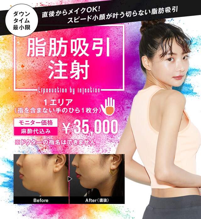 脂肪吸引注射 脂肪吸引なら湘南美容クリニック 公式 脂肪吸引注射 脂肪吸引なら湘南美容クリニック 公式