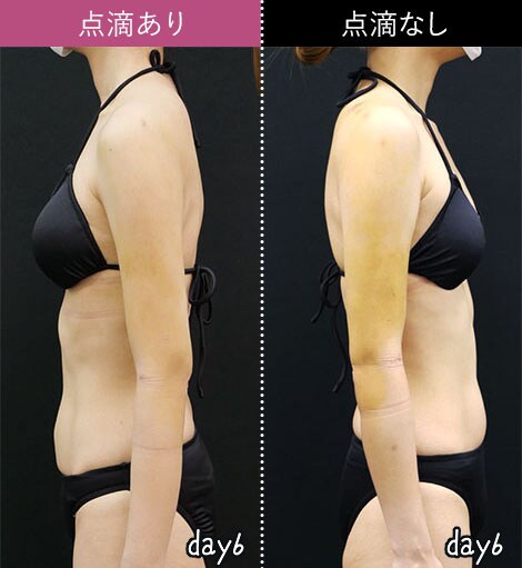 photo_drip05.jpg?202621291852