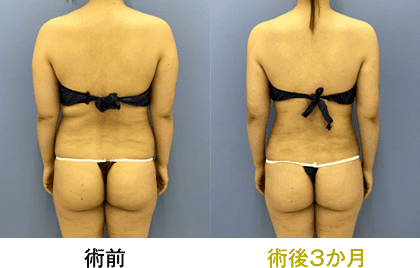 ピックアップ症例写真03