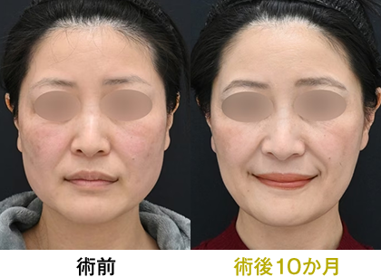 ピックアップ症例写真02