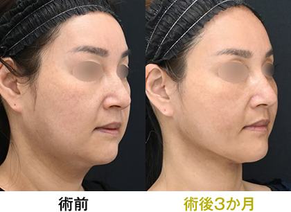 ピックアップ症例写真03