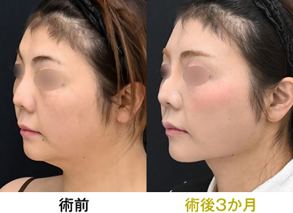 ピックアップ症例写真04