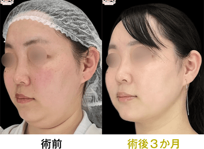 ピックアップ症例写真10