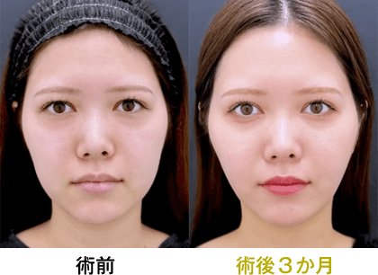 ピックアップ症例写真04