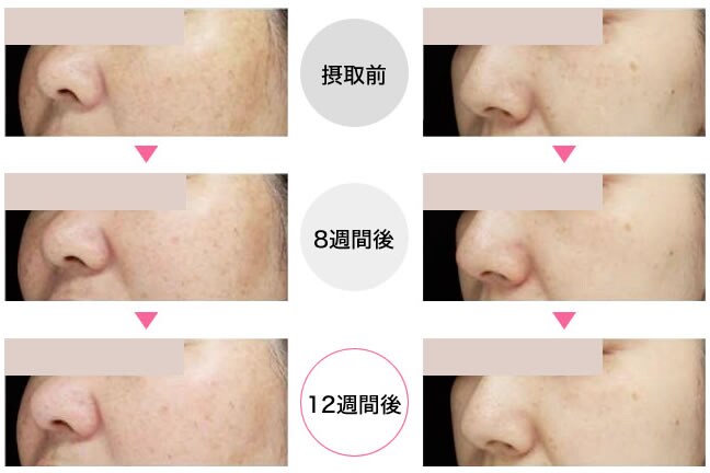 ソルプロプリュスホワイト 飲む日焼け対策 透明感 内服 外用薬 その他商品なら湘南美容クリニック 公式