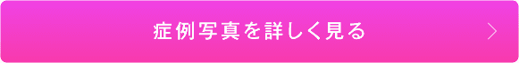 症例写真を詳しく見る