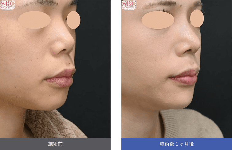 症例写真2