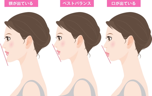 顎が出ている／ベストバランス／口が出ている