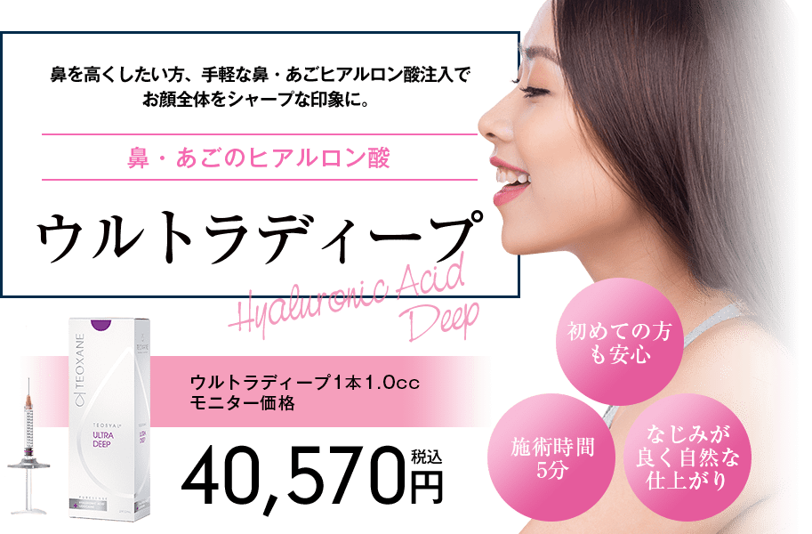 ウルトラディープ
