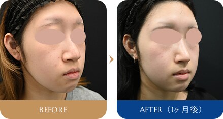 稲川 喜一 医師 鼻フルスタンダード 症例写真4