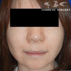 症例写真
